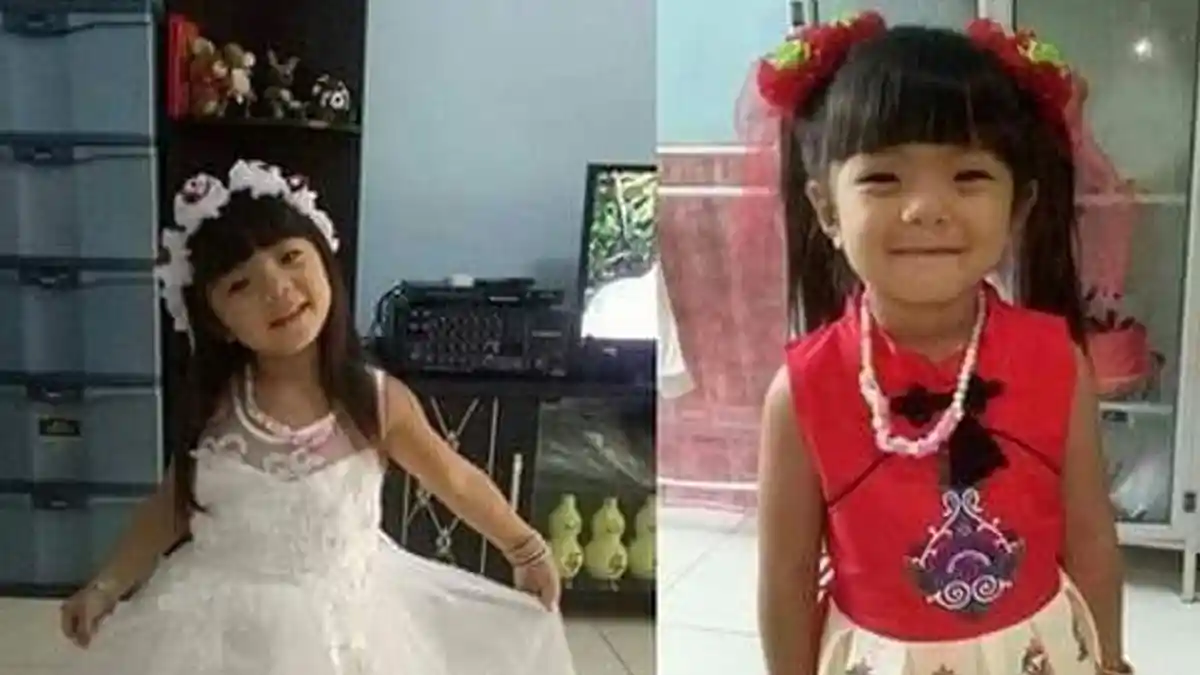 Viral Mishael Tannaka Bocah 8 Tahun Digigit Anjing Pitbull, Sang Ibu Minta Tolong Biaya Perobatan