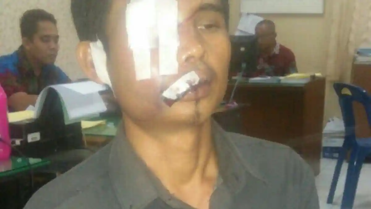 Mekanik Sepeda Motor Babak Belur Usai Keluar Dari Warung Tuak