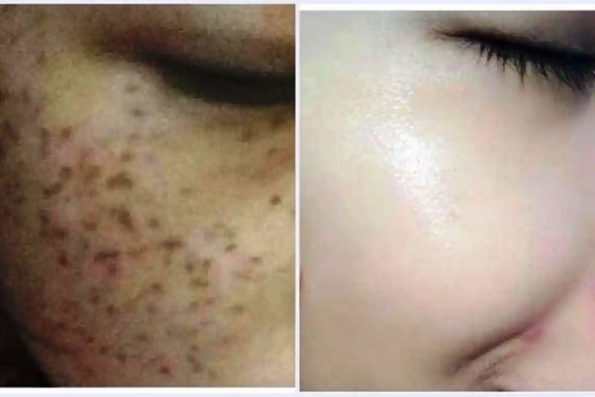 Ibu 43 Tahun Oleskan Campuran Jahe dan Bahan Ini di Wajah, 30 Menit Kemudian Efek Fantastis Terlihat