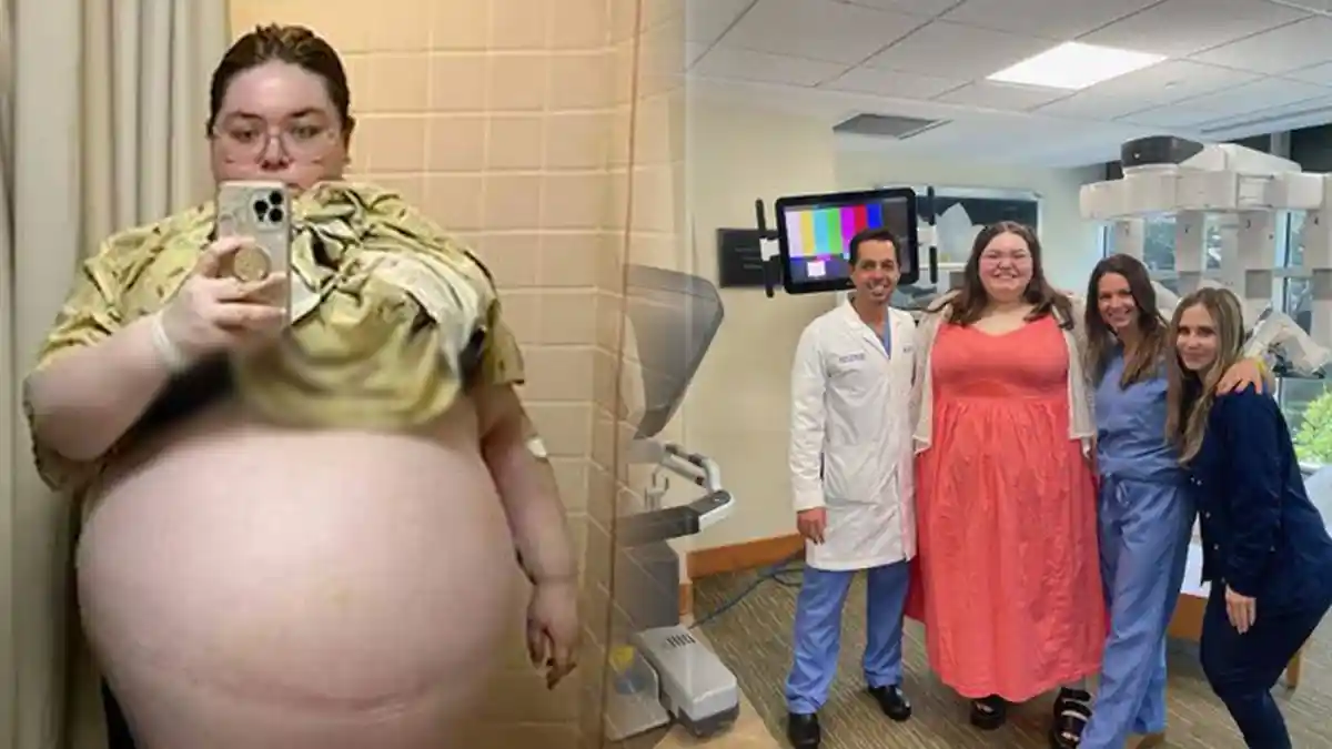 Viral Perut Wanita Ini Terus Membesar Bak Hamil 10 Bayi, Ternyata Faktanya Lebih Mengerikan