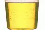 urine_20170821_195021.jpg