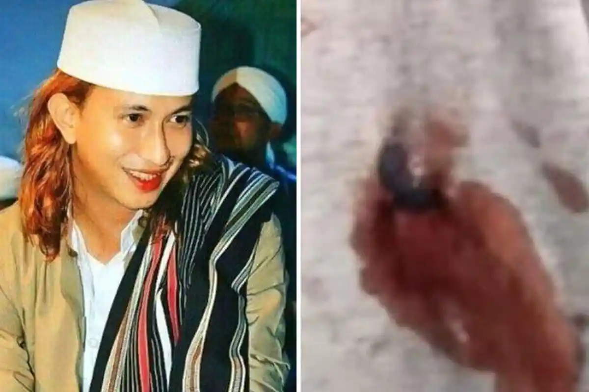 Apa Benar Habib Bahar Ditembak OTK? Tak Ada Saksi Mata, Bukti Hanya Bercak Darah, Luka Perut Divisum