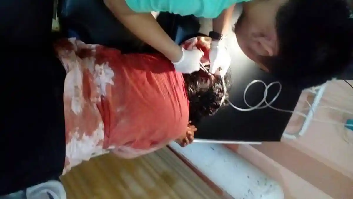 Seorang Ibu Bersimbah Darah Jadi Korban Perampokan Modus Pura-pura Bertamu