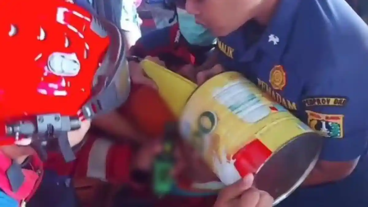 Viral, Dari Main-main, Kepala Anak Tersangkut Kaleng Susu di Jakarta Timur 