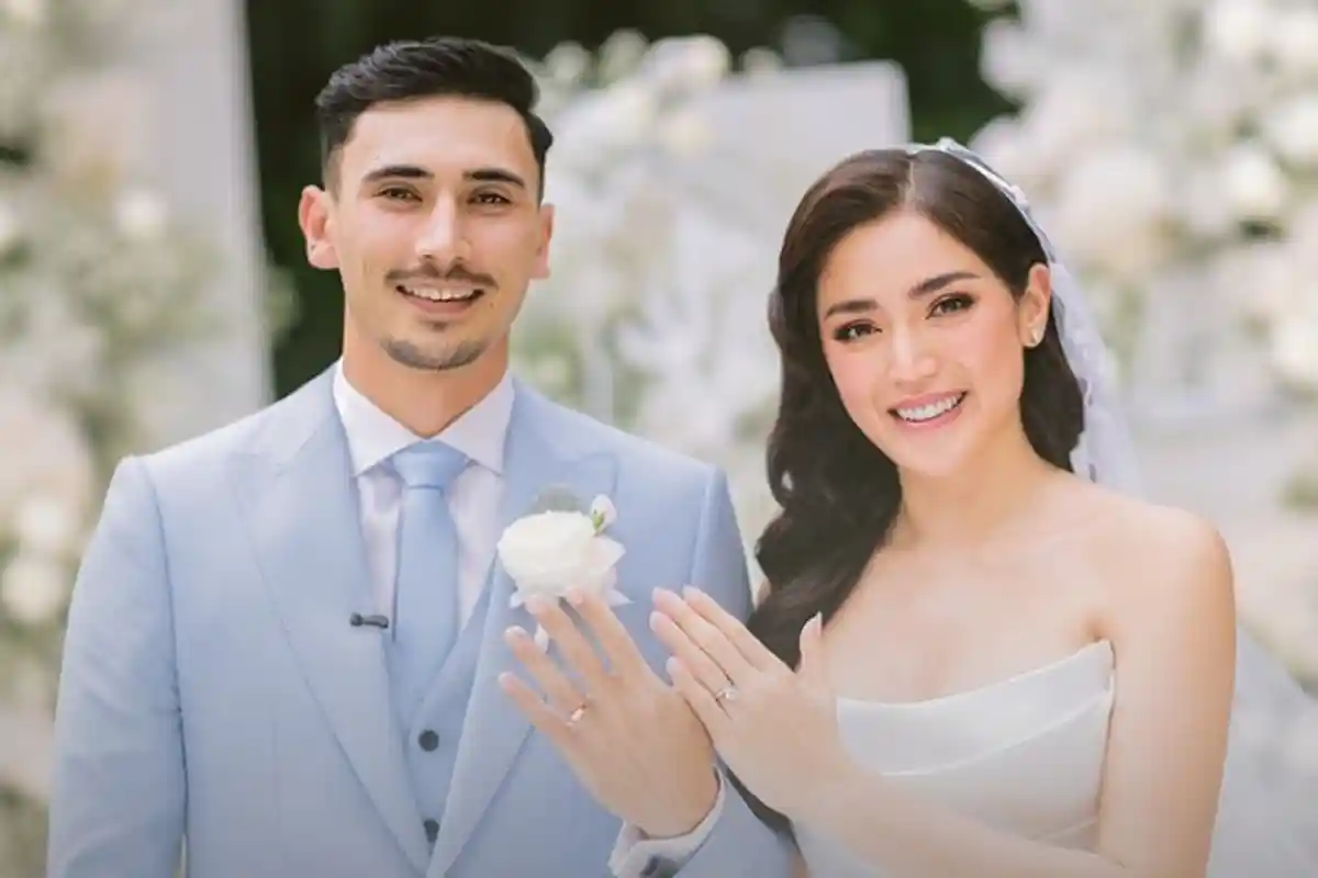 Pernah Dikabarkan Terjerat Utang, Jessica Iskandar Justru Operasi Plastik di Korea Selatan