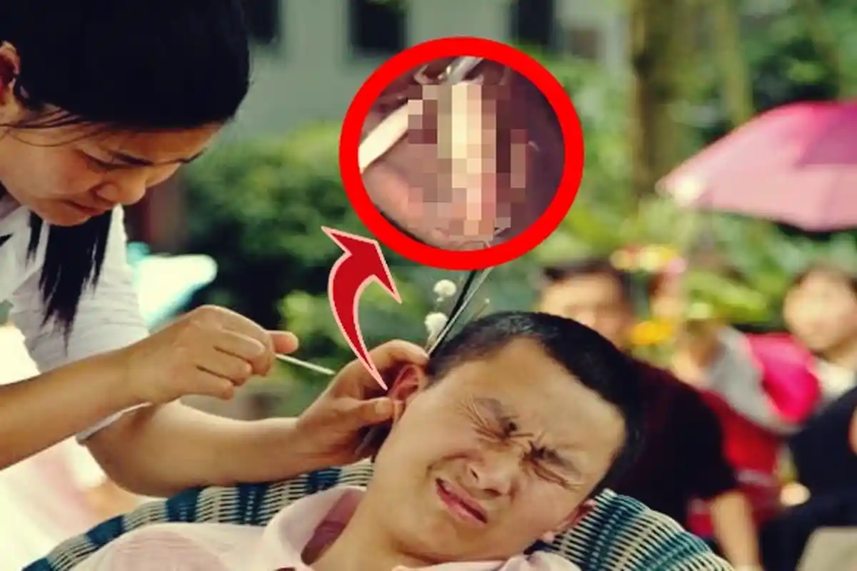 Keluhkan Telinga Gatal, Pria Buat Tim Medis Syok Saat Keluarkan 'Benda' Mengerikan Ini !