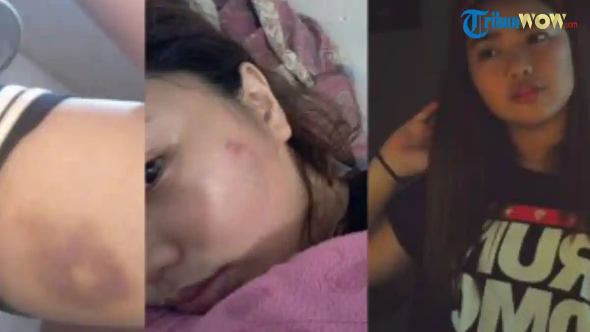 3 Tahun Menjalin Hubungan, Wanita Ini Bongkar Perilaku Kejam Sang Kekasih Selama Berpacaran!