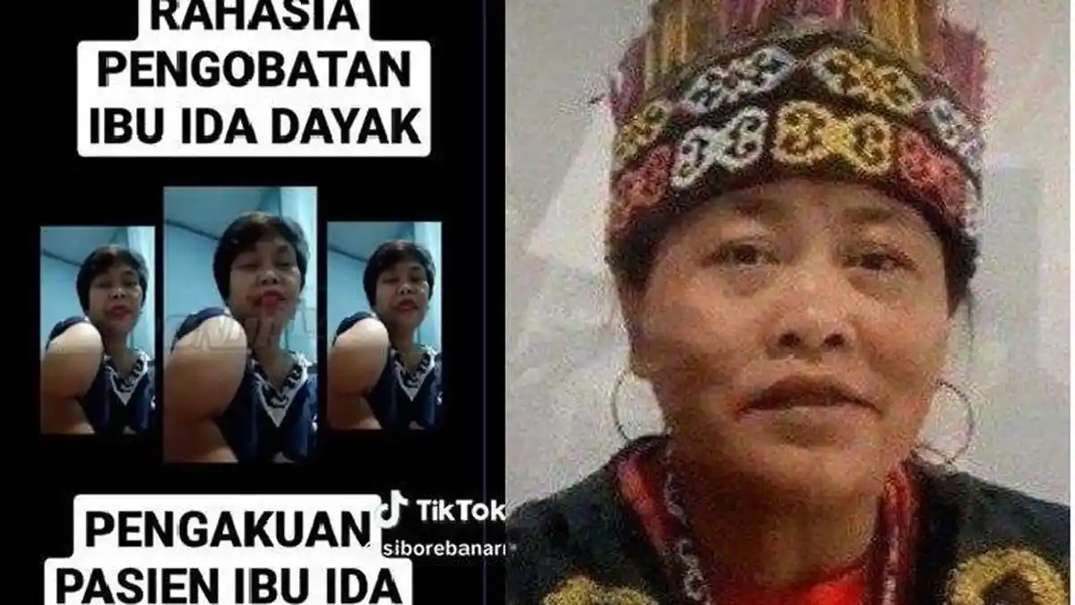 Diklaim Sakti, Wanita Ini Protes ke Ida Dayak Tangannya tak Kunjung Sembuh, Kini Tagih Janji