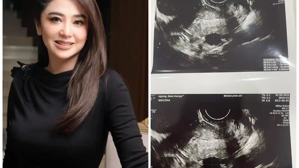 Pamer Hasil USG, Dewi Perssik Bungkam Haters yang Buat Gosip Mandul