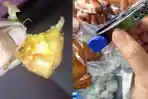 Nyaris, Seorang Remaja Hampir Tertelan Staples saat Makan Gorengan