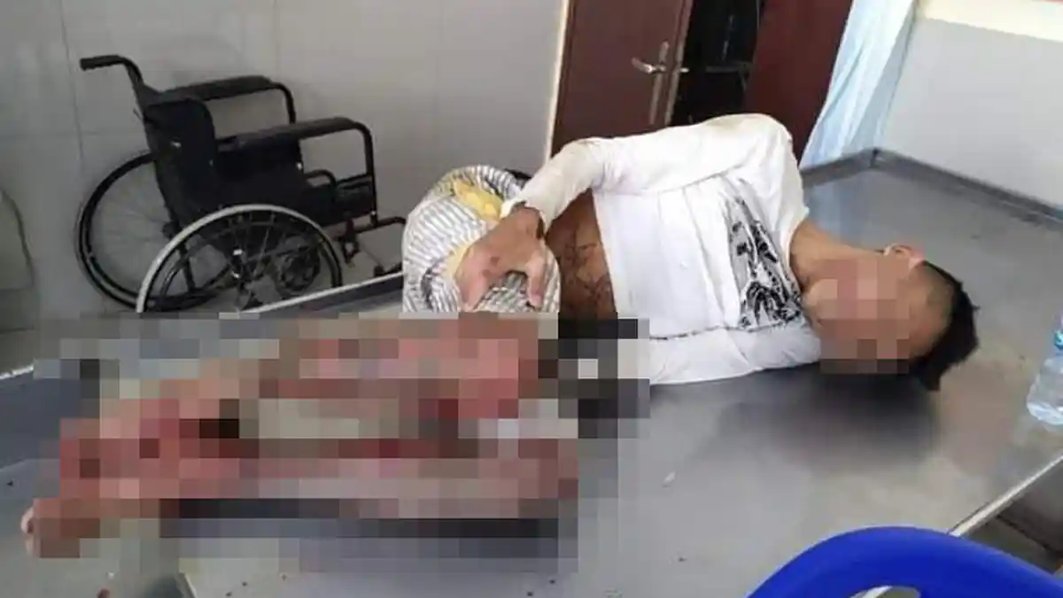 Tim Macan Polres Manado Amankan Pelaku Pembunuhan di Wonasa, Pelaku Ditembak di Kaki