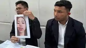 Kuasa-hukum-memperlihatkan-foto-wajah-korban.jpg
