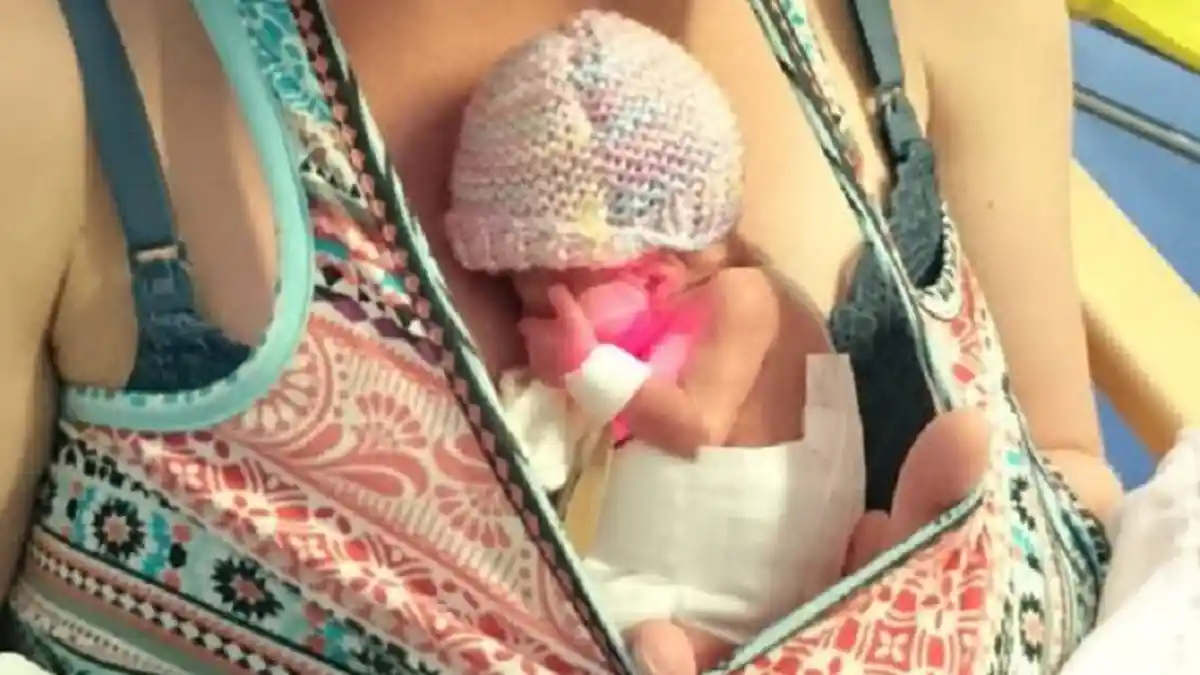 Mukjizat Allah! Bayi Prematur 28 Minggu Ini Bisa Hidup Normal