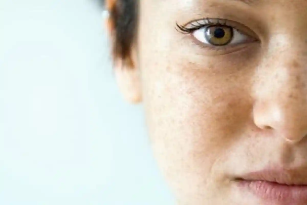 Flek Hitam dan Mata Panda Jadi Musuh Wanita untuk Tampil Cantik, Kenali Gejala dan Cara Mengatasinya