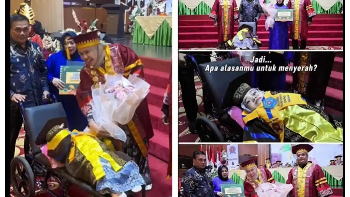 Kisah Putri, Difabel yang Berhasil Jadi Sarjana Komputer, Hadiri Wisuda dengan Tubuh Terbaring
