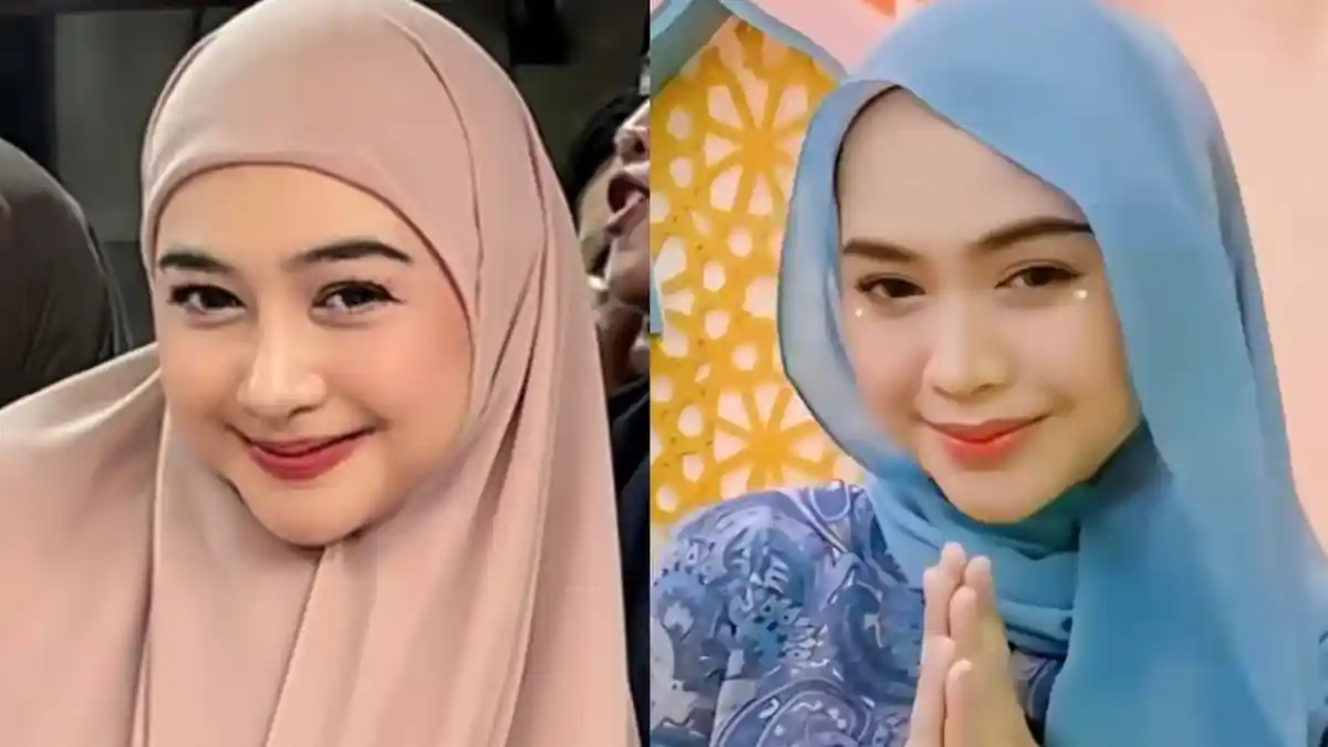 Perubahan Wajah Baru Ria Ricis Setelah Operasi Hidung, Kini Tampil ...