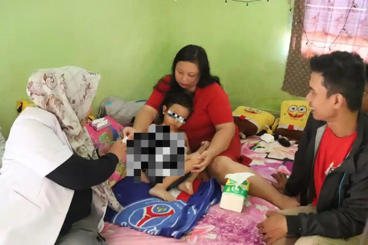 Bakar Sampah, Bocah 5 Tahun di Jepara Malah Alami Luka Serius di Perut, Polisi Datang Beri Bantuan