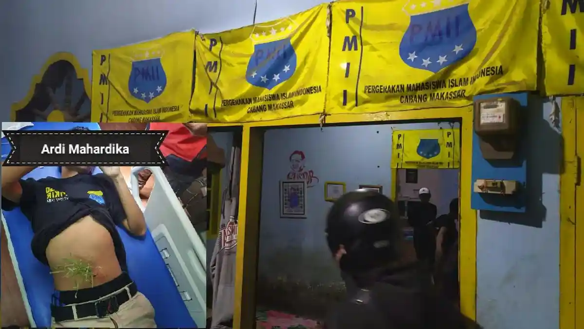 Begini Kondisi Ardi Mahardika, Korban Penyerangan Pria Bertopeng di Sekretariat PMII Makassar