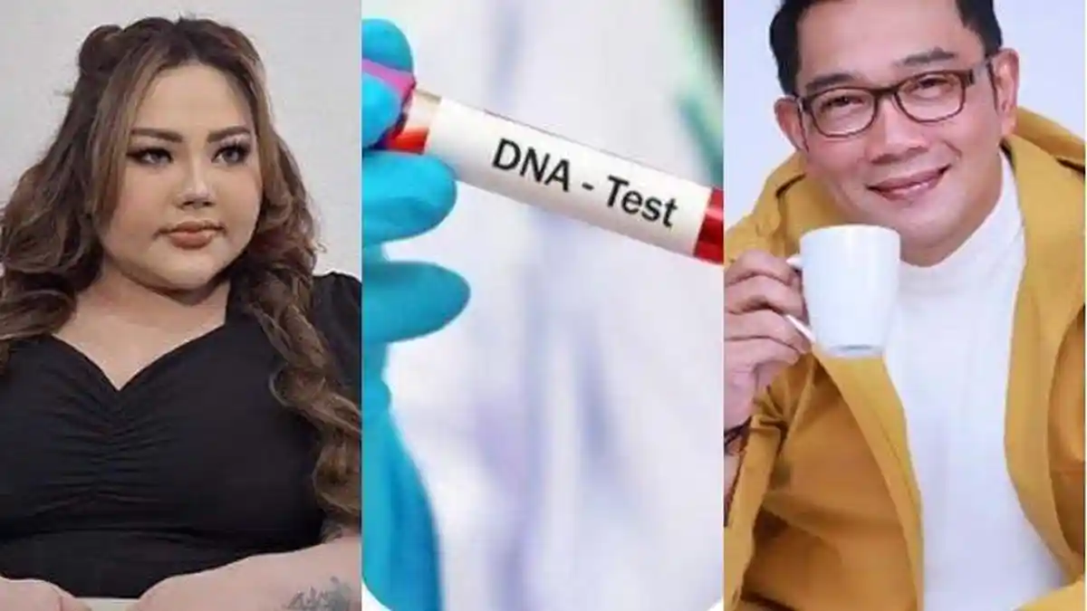 Hasil Tes DNA Keluar Hari Ini, Lisa Mariana Yakin Positif, Ridwan Kamil Cabut Laporan Jika Negatif