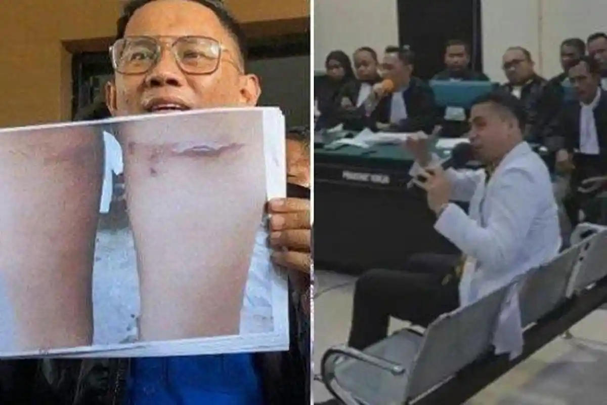 Analisis Dokter Forensik Soal Luka Anak Aipda WH Terbukti, Rekan Guru Supriyani Beber Fakta Ini