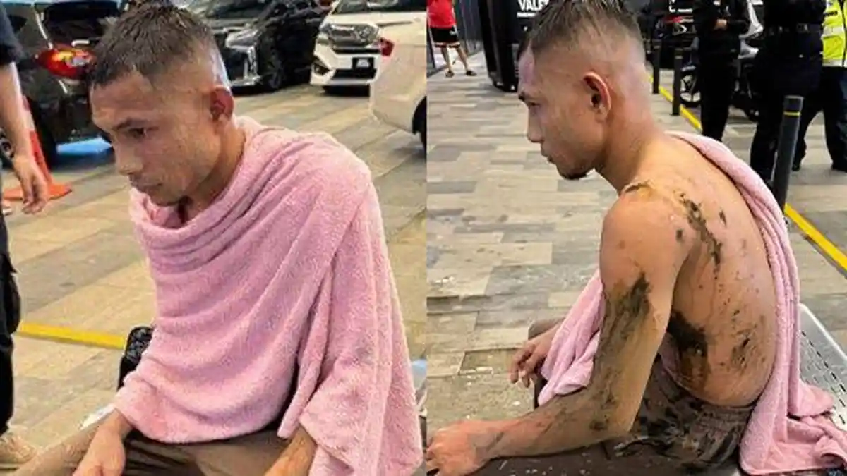 KONDISI Terkini Faisal Halim Cristiano Ronaldonya Malaysia Usai Disiram Air Keras Mulai Dari Kepala