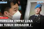 ARIF-RACHMAN-Bongkar-Luka-Tembak-di-Jenazah-Brigadir-J-saat-Pertama-Kali-Mau-Diotopsi.jpg