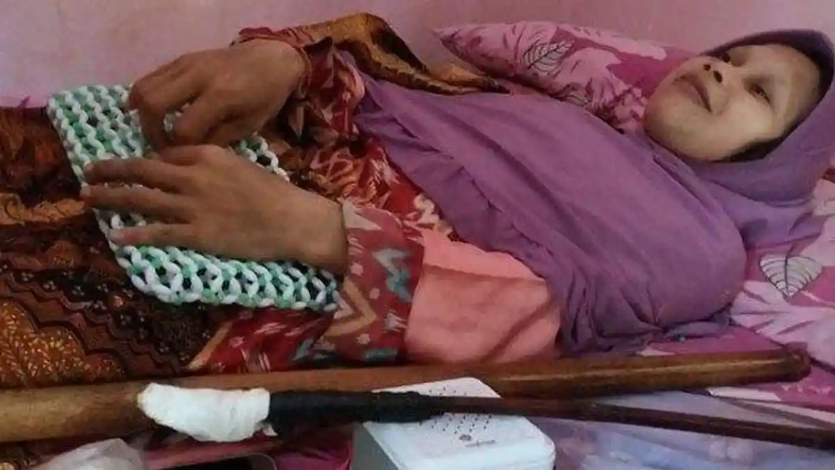 SOSOK Sulami 'Manusia Kayu' Meninggal Dunia: Tak Pernah Ngeluh Meski ...