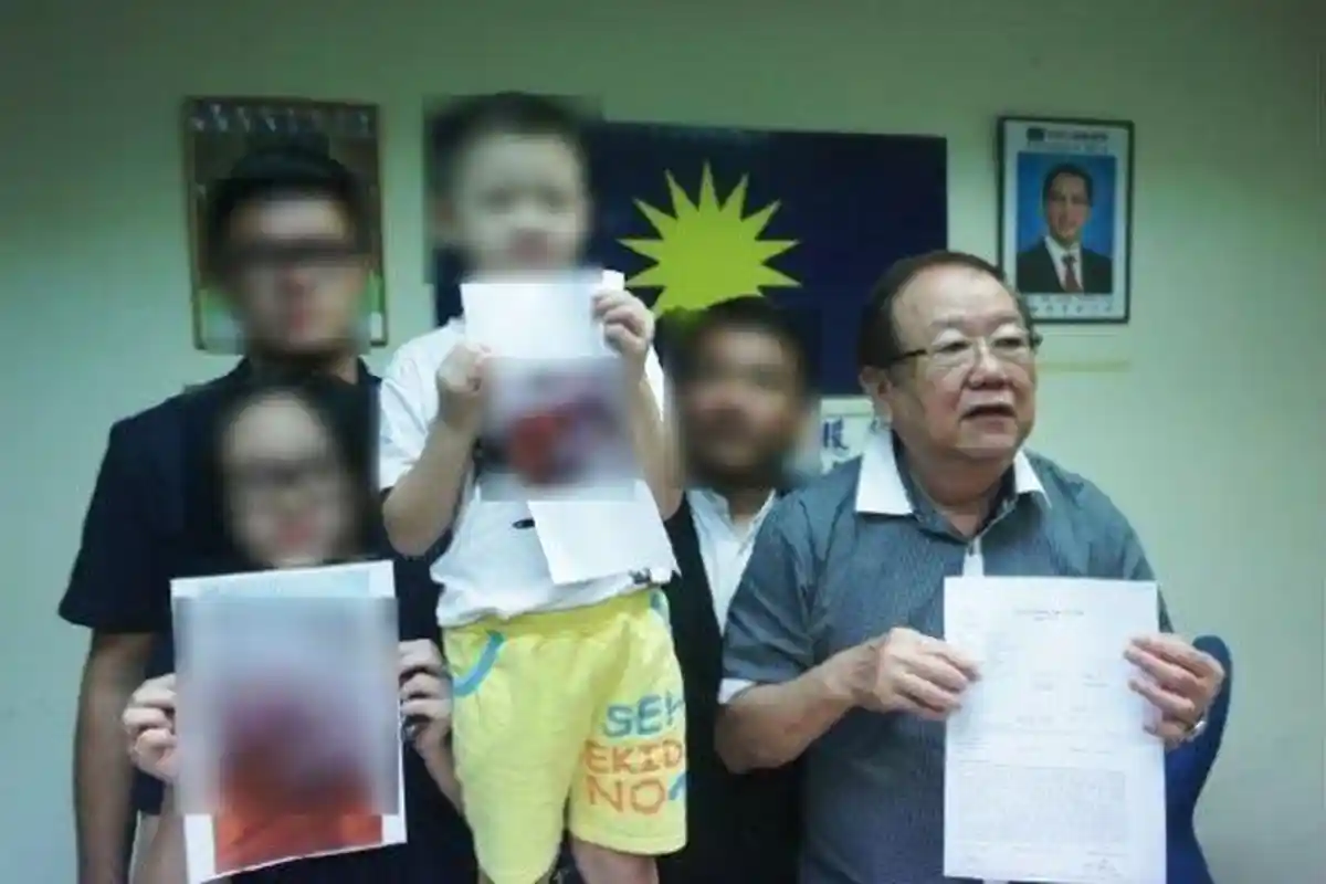 Astaga, Kelamin Siswa TK Ini Dicubit Gurunya Sampai Memar dan Terluka. Penyebabnya Sepele!