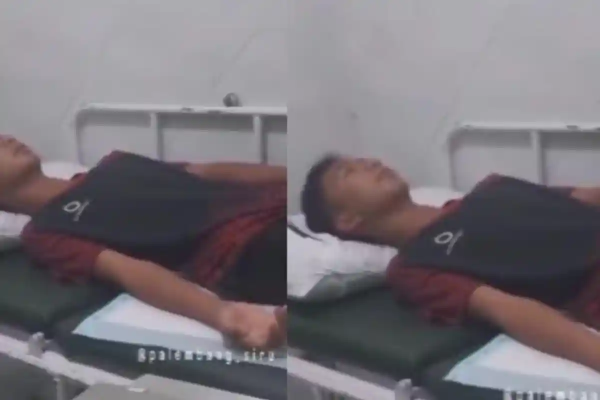 Nasib Pilu RAR, Remaja di Palembang Dibakar Teman, Sempat Kabur dari Ponpes, Tak Kuat Tahan Sakit