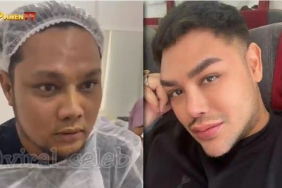 Virgoun Disebut Mirip Ivan Gunawan Usai Permak Hidung, Warganet: Perbaiki Akhlak Juga!