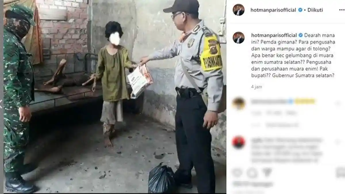 VIRAL Dua Kakak Beradik di Sumsel Kelaparan Hingga Kurus dan Tak Terurus, Hotman Paris Sindir Pemda