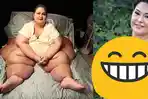 Tahu Wanita Terberat di Dunia Seberat 500 Kg? Sekarang Beratnya Hanya 90 Kg, Sungguh Berbeda!
