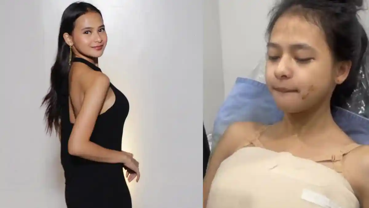 Cathy Fakandi Pamer Before After Operasi Perbesar Payudara, Kini Pede Kemana-mana Pakai Tank Top
