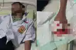 Tolak Damai, Keluarga Korban Perundungan di Pati Minta Potongan Jari Digali untuk Bukti Visum