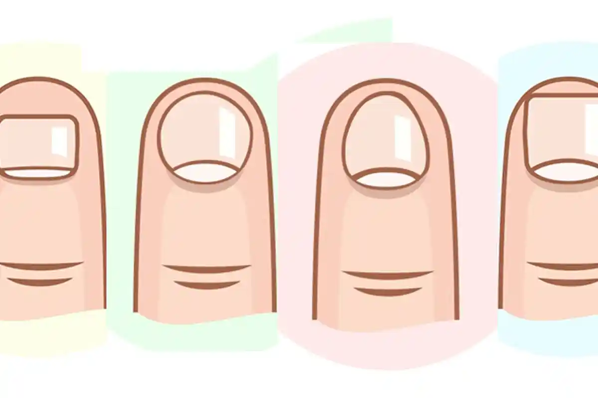 Bentuk Kuku Ternyata Bisa Ungkap Kepribadian Seseorang, Kamu yang Mana?