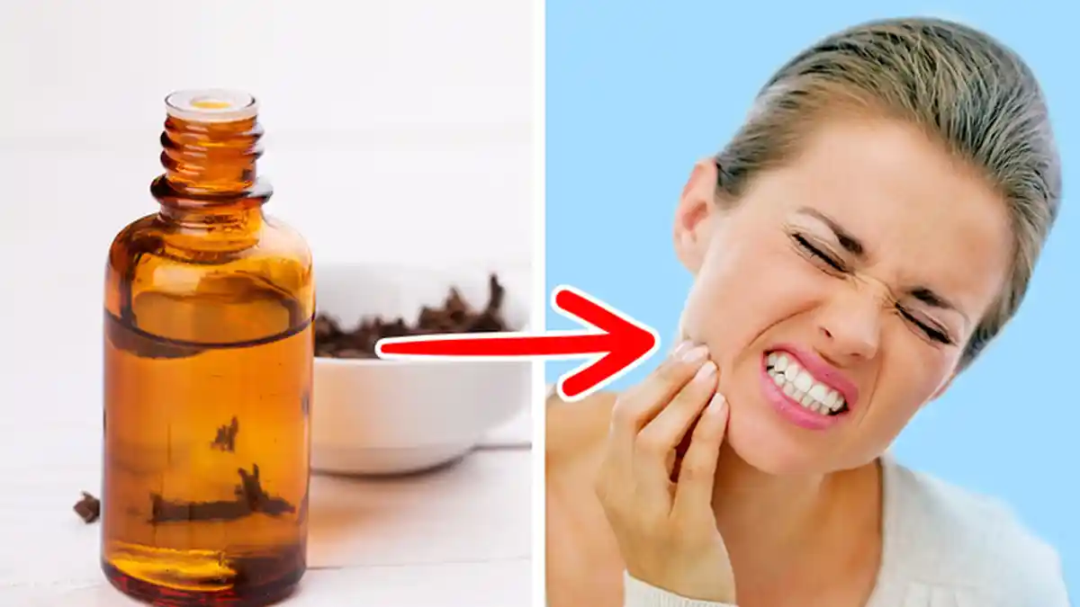 6 Cara Mudah Mengatasi Sakit Gigi dengan Bahan-bahan yang Ada di Rumah