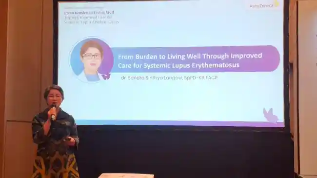 Lupus Banyak Serang Wanita Muda, Gejala Sepele Sering Terlambat Dideteksi