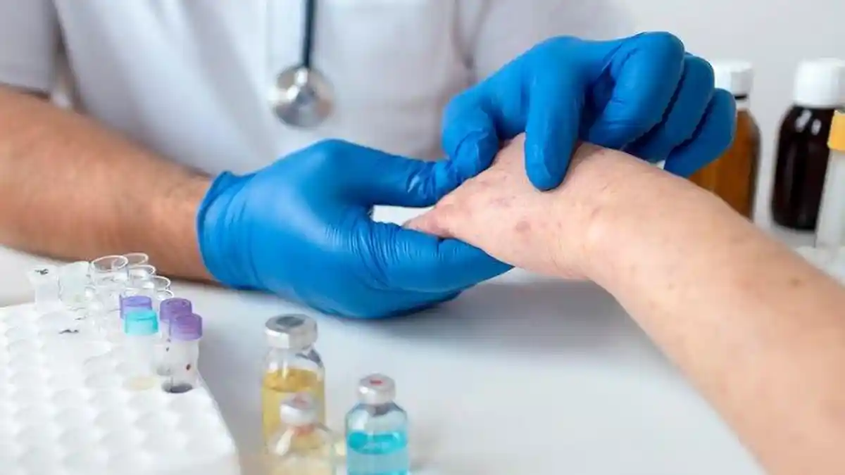 Curiga Anak Terserang Lupus, Deteksi dengan 11 Pertanyaan Ini