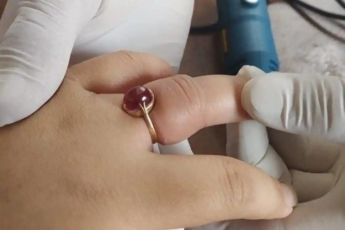 Lagi, Damkar Majenang Cilacap Dipanggil untuk Bantu Lepas Cincin. Kali Ini di Jari ODGJ