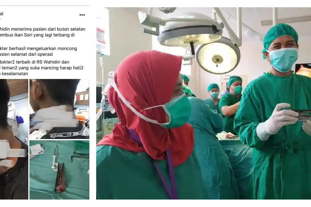 Tertancap Ikan Sori di Leher, Muh Idul Dioperasi, Begini Penjelasan Dokter Bedah dari RSUP Wahidin?