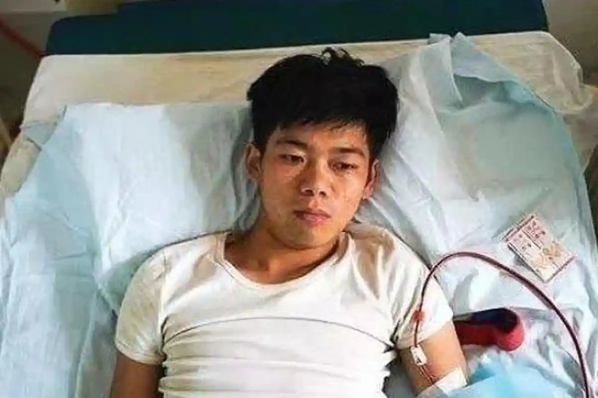 Nasib Buruk Remaja Jual Ginjal demi iPhone, Keadaannya Memprihatinkan