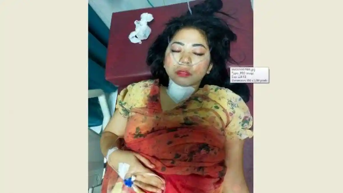 Wanita Medan Dihujami 10 Tikaman dan Dirampok Teman Pria, Pelaku Bawa Kabur Mobil dan HP Korban