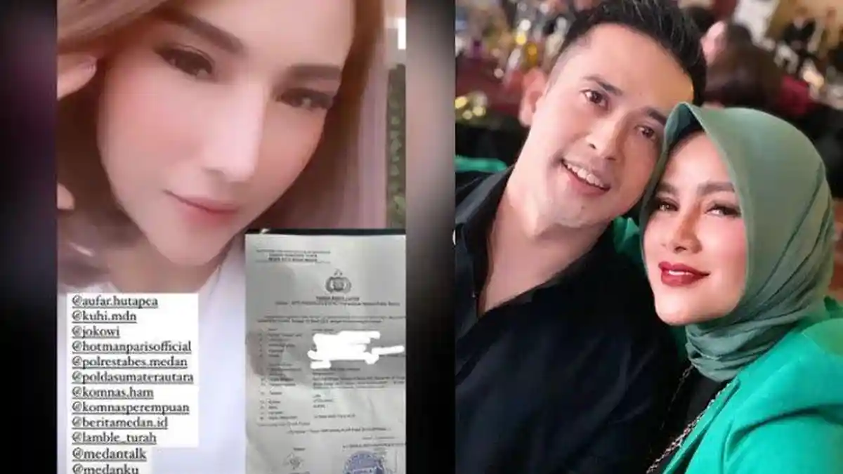 Ngaku Dilecehkan & Dianiaya, Selebgram Citra Andy Minta Keadilan, Seret Nama Suami Olla Ramlan