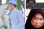 Calon Istri Kecelakaan hingga Wajah Luka, Pria Ini Tetap Mau Nikahi, Pengakuannya Bikin Tersentuh