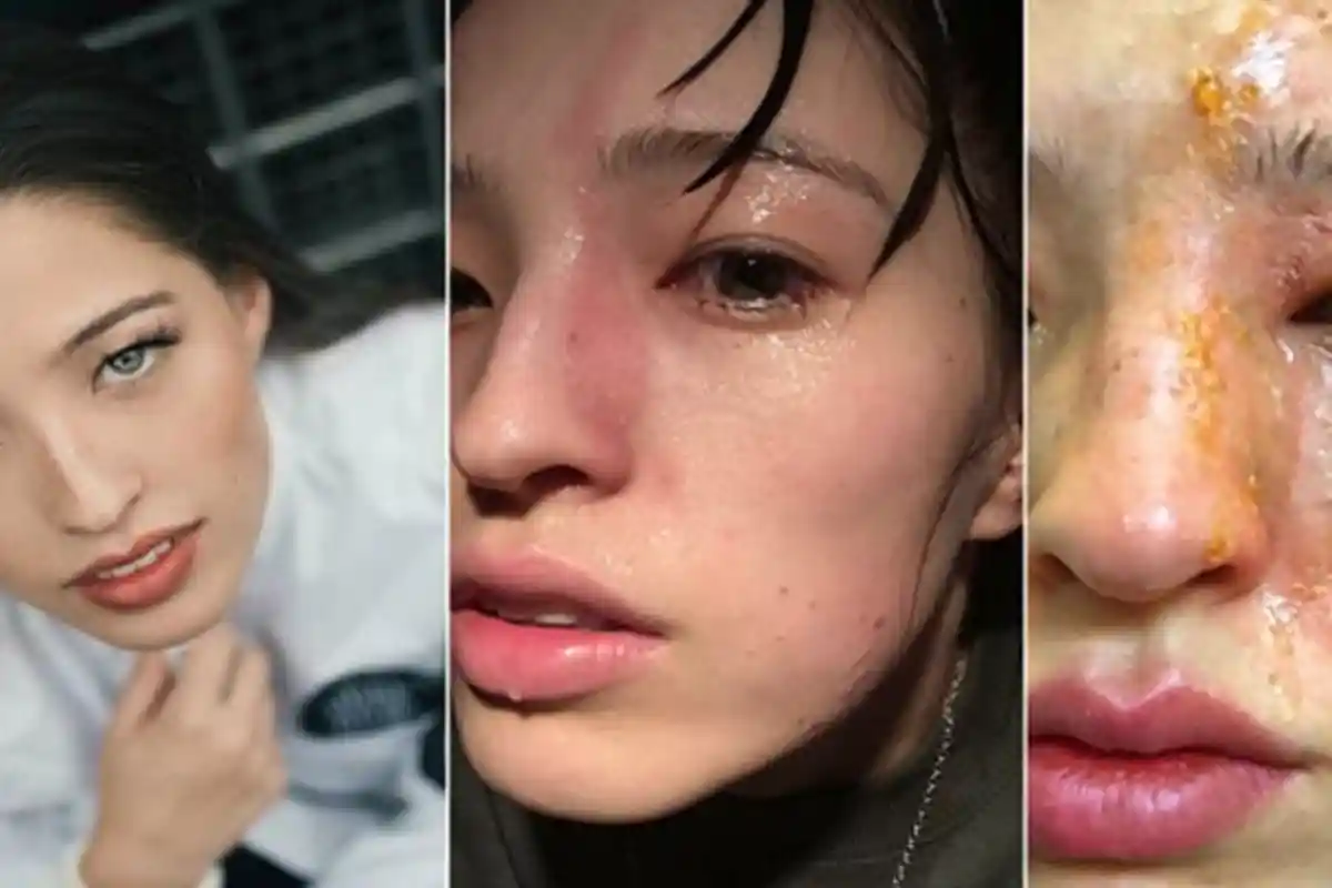 Tak Sengaja Kena Minyak Esensial Pewangi Ruangan, Wanita Ini Cacat Seumur Hidup!