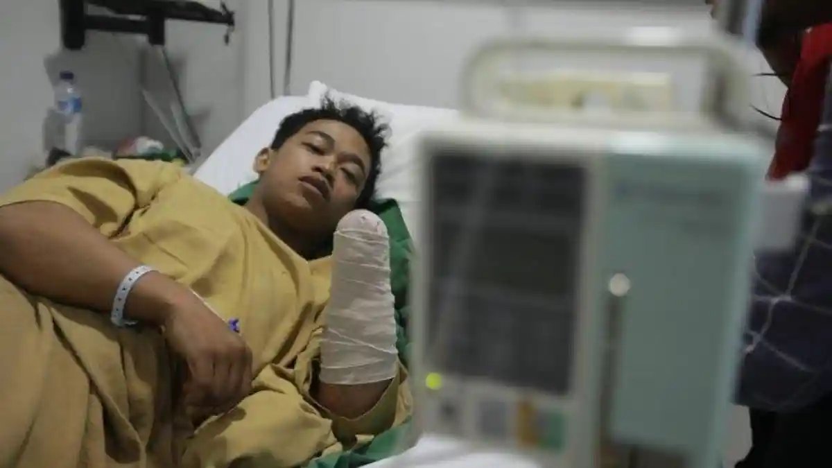 Viral Kisah Pilu Mahasiswa Makassar, Tangannya Ditebas Begal, Sempat Dikira Korban Mutilasi
