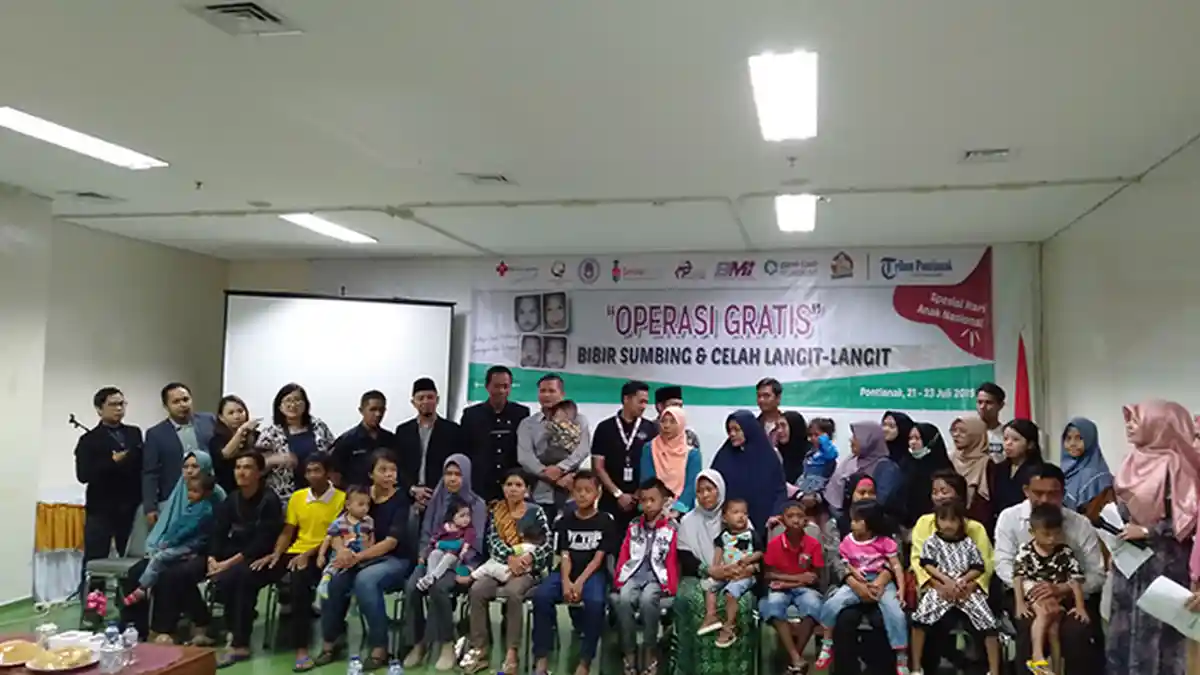 Yayasan Munzalan Gelar Operasi Bibir Sumbing Gratis, Ringankan Beban Masyarakat