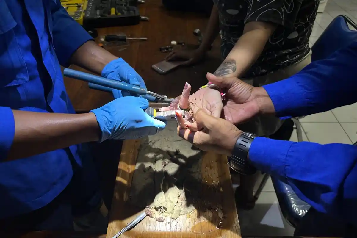 Jari Manis Perempuan Trenggalek Ini Tersangkut Mata Gerinda, Malam-malam Datangi Kantor Satpol PP