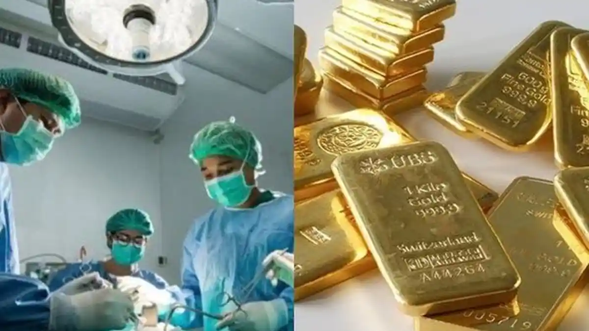 Ngaku Telan Tutup Botol, Dokter Malah Temukan Benda Berharga Ini Dalam Perut Pasiennya
