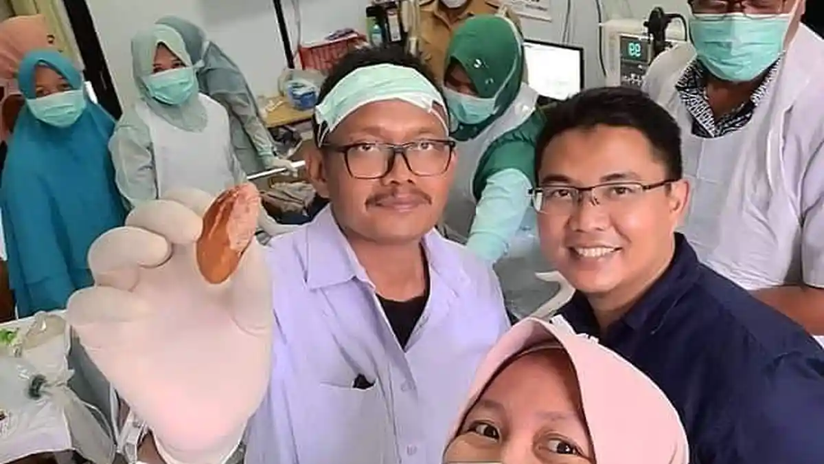 Pria Ini Tertelan Biji Durian dan Nyangkut di Kerongkongan, Tim Dokter Dikumpulkan, Ini Hasilnya!